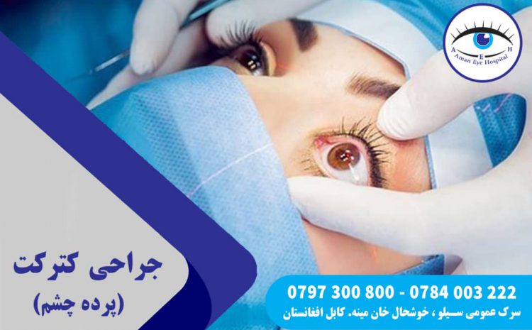  Eye Cataract Surgery